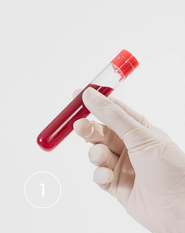 Blood Test